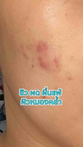 Summer Glow Blue Intensive Glow Mask 💦 ครีมมาส์กหน้าเข้มข้น สารสกัดพรีเมียม 250ml