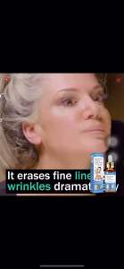 SOL LORA 抗皱原液 淡化肌肤细纹黑斑补水滋润嫩肤防衰精华液