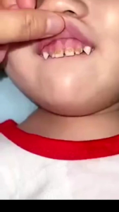 Sikat Gigi Anak U A94 Perawatan Gigi Anak  Training Toothbrush  Tooth Brush Baby Silicon type U 360°