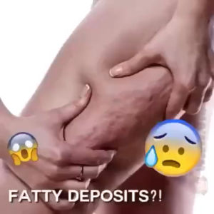 AICHUN CREAM CHILI GINGER HOT CREA Krim panas berasaskan cili dan halia semulajadi pelangsing badan bakar lemak buncit boroi kuruskan badan slimming hot cream