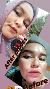 WITA SKINCARE