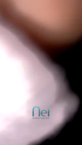 Nei Peeling Spray Penghilang Daki Pembersih Leher Hitam Perontok Daki Leher Mengangkat Sel Kulit Mati Mencerahkan Area Hitam