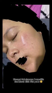 LETSGLOW Skincare | Paket Skincare Wajah Letsglow Lengkap Eceran