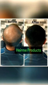 heirme hair fiber toolkit peralatan perlengkapan hair fiber penebal rambut isi 3 dan 4 sudah BPOM