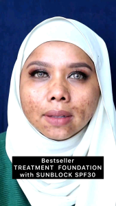 🇸🇬 NRC SPF30 PERFECTION TREATMENT FOUNDATION (FAST SHIPPING)