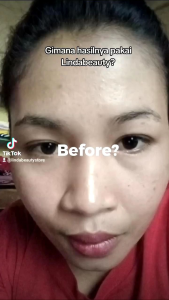 Lindungi Kulit dengan DNA Salmon & Penghilang Flek Hitam Alami
