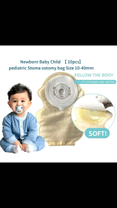 Newborn Baby Child Pediatric Stoma Ostomy Bag 10pcs Size 10-40mm