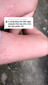 CAO BÔI TRỊ RẠN DA