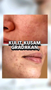 sabun susu etawa
