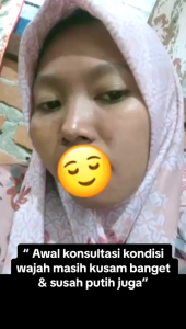 (BONUS)PAKET BRIGHTENING PLATINUMN ORLIN BEAUTY