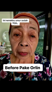 serum anti aging/serum flek