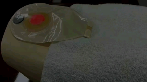 15ml Ostomy Stoma Adhesive Wipe-off Spray