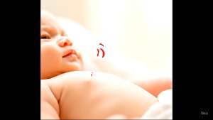 Kem Bôi BABY TONY Tuýp 15gram - Dưỡng ẩm mềm da dịu mát mờ thẹo