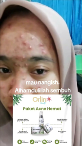 Night Cream Acne Krim Malam Orlin Beauty: Mencerahkan & Melembabkan Kulit