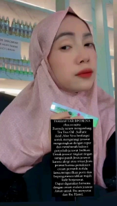 Serum Acne Orlin Beauty / Serum mengecilkan pori-pori menyamarkan bekas jerawat & bopeng / skincare bpom ( free gift cantik)