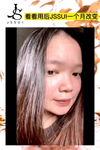 🚚 Free Shipping💥Ready Stock💥 *100% Original 正品 * JSSUI Skin Care Set Facial Treatment Gel 大黑瓶婴儿肌 还你婴儿肌 嫩滑肌肤 细致毛孔 镇定肌肤
