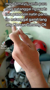 Korean Ginseng Oil 30ml: A Multi-Purpose Solution for Varicose Veins, Warts & Back Pain