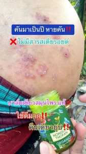 บาล์มนงลักษณ์ 1แถม1 ได้2 ขวด พร้อมส่งของแท้