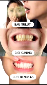 Pasta Gigi Siwak & Sirih SR12