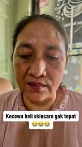 BONUS POUCH KOSMETIK: PALET FLEK PLATINUM ORLIN BEAUTY SOLUSI FLEK TEBAL & TIPIS KRIM PENGHILANG FLEK ORLIN BEUTY KRIM PENCERAH WAJAH KUSAM BPOM ORLIN SKINCARE FLEK&KERUTAN SKINCARE UNTUK REMAJA KULIT NORMAL MEMUDARKAN FLEK ORLIN SKINCARE VIRAL ORLIN