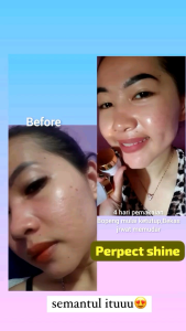 Paket Skincare Lengkap Perfect Shine: Sabun, Toner, Serum, Cream Siang & Malam