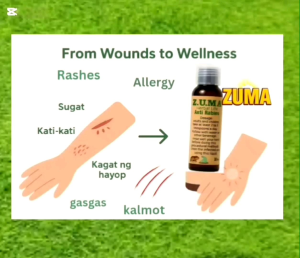 ZUMA HERBAL 30ml/100ml All in one healing solution natural remedy for Wounds Bites anti-Itch Allergy & Dengue defense