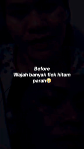 Gold Jelly Kedas Beauty isi 10 gram skincare perawatan wajah pelembab bisa untuk pria dan wanita