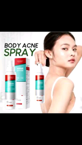 150ml Ance Body Treatment Spray penghapus jerawat badan 祛痘美背喷雾