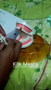 DIY Gigi Palsu (Cara Alternatif) untuk gigi hilang sebatang