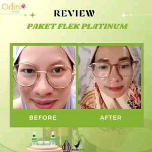 Orlin Beauty Skincare Cream Orlin Paket Pencerah Orlin Flek Orlin Brightening Orlin Acne
