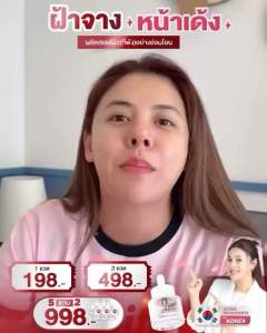 เซรั่มใบเฟิร์น Ultra Bright Serum 15ml. ส่งฟรี เซรั่มชะเอมเกาหลี ผิวอิ่มฟูฉ่ำน้ำ ผิวกระจ่างใส เซรั่ม