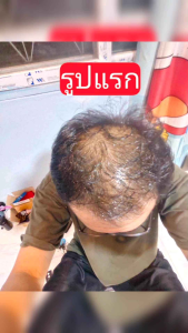 แชมพูสมุนไพรคุณยาย ลดร่วง ล้าน บาง คัน รังแค