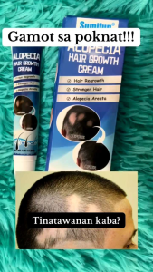 AUTHENTIC ALOPECIA HAIR GROWTH CREAM