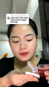 Promo!! Beli 1 dapat 2 Toner Flek Hitam Facetonic Aloevera Efektif Membersihkan Flek Hitam & Noda Bekas Jerawat