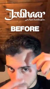 Serum Penumbuh Rambut MINOXIDIL Alami Izdihaar | Botak Rontok Alis Kumis Brewok Herbal 60ml (GRATIS DERMAROLLER*)