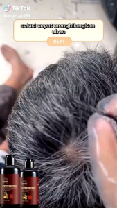 [PROMO]Yurizumi Shampoo Penghitam Rambut Uban Permanen 300ml Shampo herbal yang membantu menghitamkan rambut uban secara alami dan permanen