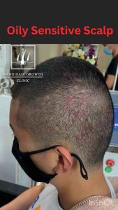 NANO HAIR GROWTH CLINIC Scalp Cleansing Shampoo