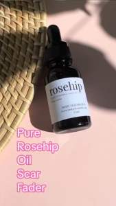 Mary Elizabeth R Rosehip Moisturizing Facial Oil for Scars and Dark Spots - Hydration and Brightening