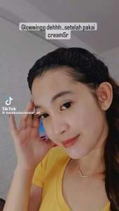 CREAM SR GLOWING & Fleksional 1 Lusin: Perawatan Kulit dan Krim Pemutih Wajah
