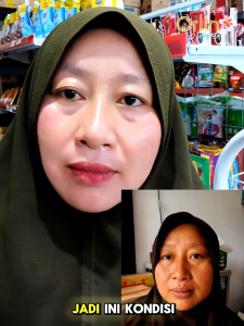 (BANYAK HADIAH) PAKET FLEK ORLIN BEAUTY/CREAM PENGHILANG FLEK HITAM BEKAS JERAWAT DAN PENCERAH KULIT WAJAH NORMAL