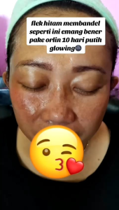 ORLIN BEAUTY/KRIM SIANG MALAM FLEK BANDEL/KRIM FLEK/GROSIR SKINCARE/ORLIN FLEK