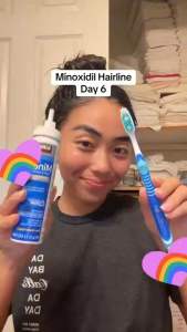 1 Can Original Kirkland Minoxidil Foam Type (1 Month Supply) Hair Grower Beard Grower Strand Eyebrow Hairline Scalp For Men and Women Treatment