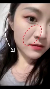 MASKER SEOMOU Garis Senyum Pipi Line V Shape Penghilang Kerutan Wajah Masker Pipi