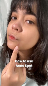 Glad2Glow Centella Acne Spot Treatment 5g