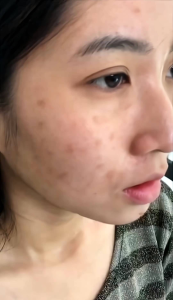 (Chính hãng Giá sỉ) Huyết thanh 7days Queenie Skin mẫu mới chính hãng 50ml .Serum dưỡng trắng da se khít lổ chân lông mờ thâm căng bóng trắng sáng da. .(mỹ phẩm Queenie Skin chính hãng )