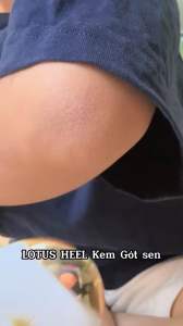 Kem dưỡng da chân LOTUS HEEL giảm tình trạng khô rát nứt nẻ giúp tái tạo da độ ẩm tự nhiên - chai 50ml