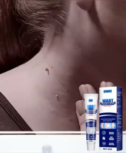 OUHOE WART REMOVER OINTMENT Krim penghilang semua jenis ketuat matikan akar ketuat