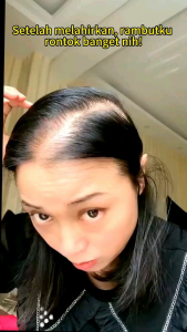 AUROR REMIMPI TREATMENT SHAMPOO - Sampo Remimpi sampo perawatan rambut bercabang dan rambut rontok