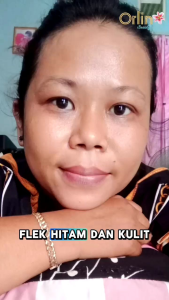 TONER FLEK ORLIN BEAUTY / Toner penyegar wajah flek hitam / toner pembersih wajah flek