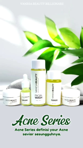 vanesa beauty skincare Acne Series